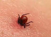 Sénégal: La fièvre hémorragique du Congo fait une victime