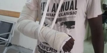 Communiqué d’indignation de l’ONG IRA, suite à la violence policière contre  les manifestants pacifiques